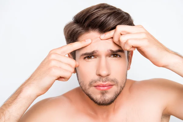 Close up foto de jovem procurando acnes em seu rosto — Fotografia de Stock