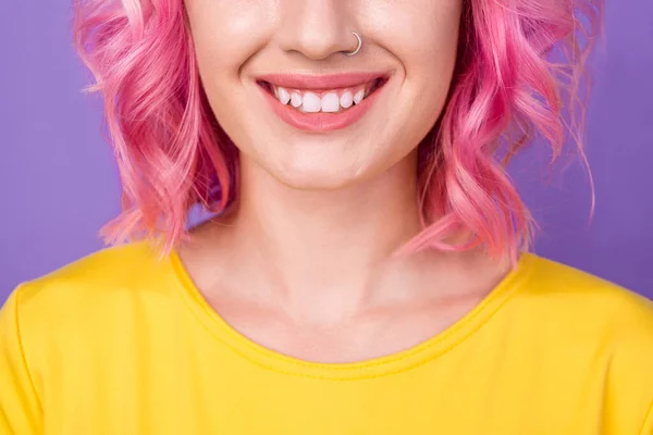 Foto cortada de menina feliz sorriso positivo do dente cerâmica cuidados orais clínica branca isolado sobre o fundo de cor roxa — Fotografia de Stock