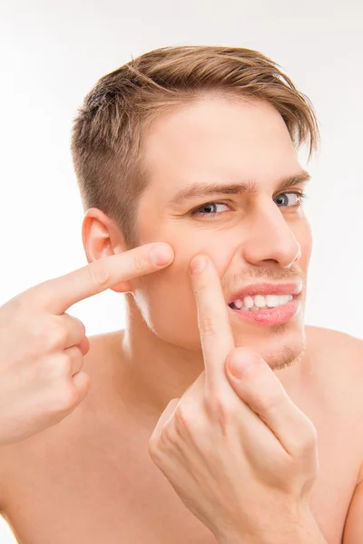 Handsome young man touching his face and crushing pimple — Stock Photo, Image
