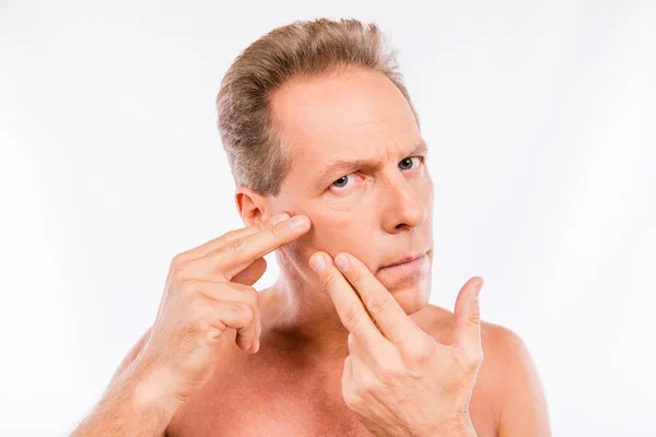 Przystojny zaburzenia wieku człowiek dotykania twarzy po goleniu — Zdjęcie stockowe
