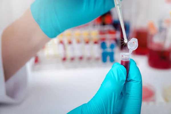 Дослідник Скидає Реагент Або Хімічну Рідину Зразки Крові Вірус Covid — стокове фото