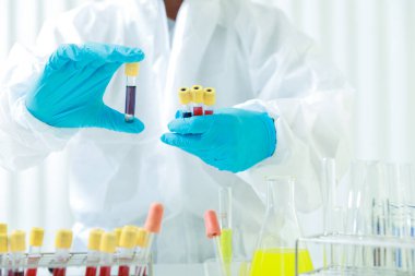 Araştırmacılar laboratuvarda hastalığa yakalanan hastaların kan örneklerini karşılaştırıyorlar. Araştırmacılar COVID-19 virüsünü tedavi etmek için aşı icat ediyorlar..