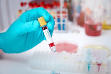 Araştırmacılar kan örneklerini laboratuvarda test ediyorlar. Araştırmacılar COVID-19 virüsünü tedavi etmek için aşı icat ediyorlar..