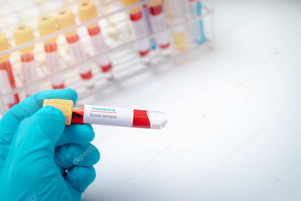 Researchers holding test tube with blood samples in the laboratory. Researchers are inventing vaccines to treat COVID-19 virus.