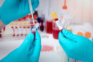 Araştırmacılar kan örneklerini laboratuvarda test ediyorlar. Araştırmacılar COVID-19 virüsünü tedavi etmek için aşı icat ediyorlar..