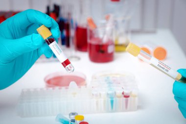 Coronavirus, COVID-19 'dan hasta olan insanların kanından alınan kan ve plazma içeren test tüpleri. İlaç ya da aşı yapımında kullanılmak üzere.