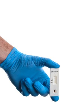 Doktor, dünya çapında beyaz salgın hastalıklar konseptine izole edilmiş Novel Coronavirus 'a IgM ve IgG antikorlarının tespiti için hızlı laboratuvar COVID-19 testi gösteriyor..