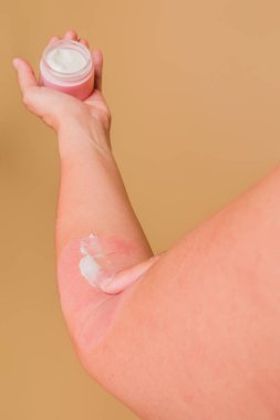 Kızarık parmaklı krem süren bir kadın, kolundaki kırmızı cilt hassas cilt bakımını gösteriyor.