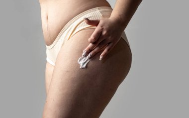 Kalçada selülit, bacaklarda deri altında yağ. Selülit tedavisi için kalça üzerinde selülit kremi. Yağlı ve kalçalı cilt kremi