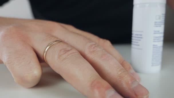 Bradavice na prstě, dermatologické onemocnění bylo léčeno speciálním lékem. Bradavice dermatologie lidská ruka kůže zblízka