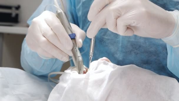 Close-up - de handen van een professionele tandarts uitvoeren van tandheelkundige ingrepen of tandheelkundige implantaten voor een patiënt — Stockvideo