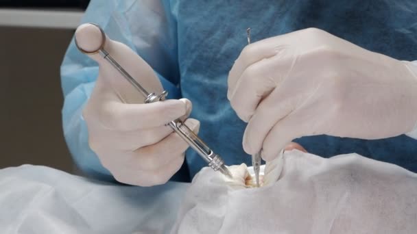 Primer plano: las manos de un dentista profesional que realiza procedimientos dentales o implantes dentales para un paciente — Vídeos de Stock