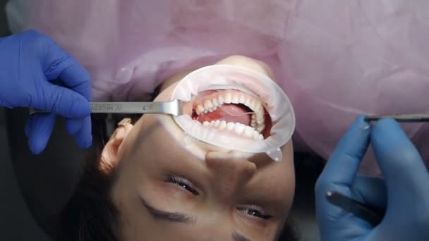 Costura. Cirurgião dentário trabalhando com um paciente em uma clínica odontológica moderna — Vídeo de Stock