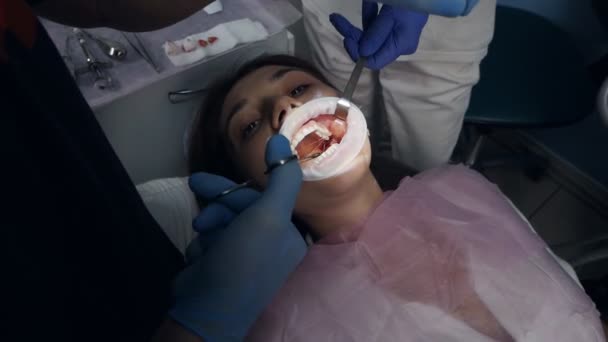 スティッチだ。現代の歯科クリニックで患者と一緒に働いている歯科外科医 — ストック動画
