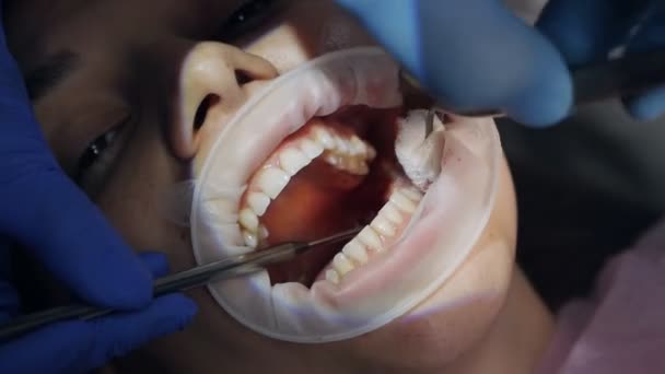 Costura. Cirujano dental que trabaja con un paciente en una clínica dental moderna — Vídeo de stock