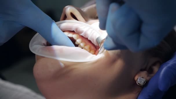Der Zahnarzt führt die Operation mit sterilen Geräten durch. Zahnarzt-Porträt. Patient im Zahnarztstuhl. Zahnpflegekonzept. — Stockvideo
