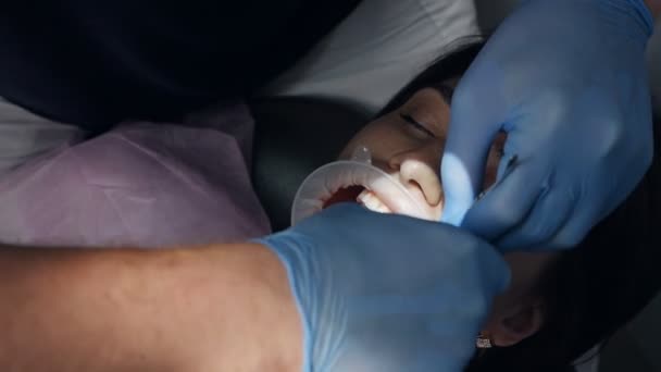 O dentista realiza a operação com equipamento estéril. Retrato de dentista. Paciente na cadeira dentária. Conceito de assistência odontológica. — Vídeo de Stock
