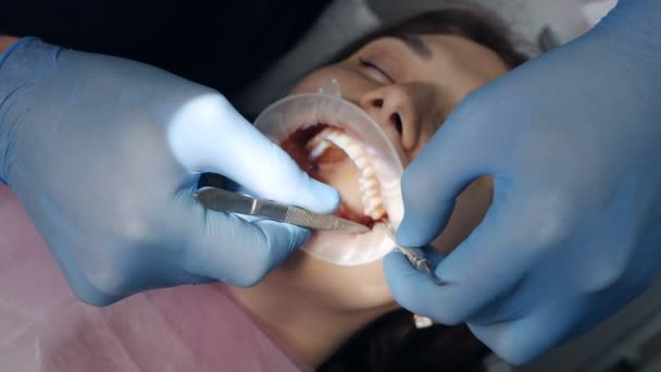 Cucitura. Chirurgo dentale che lavora con un paziente in una moderna clinica dentale — Video Stock