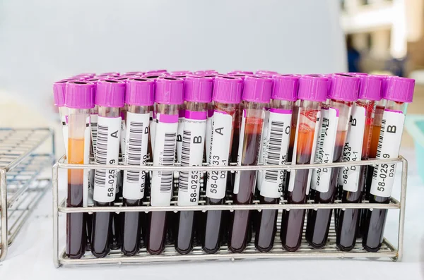 Tubo de ensayo médico con muestras de sangre — Foto de Stock