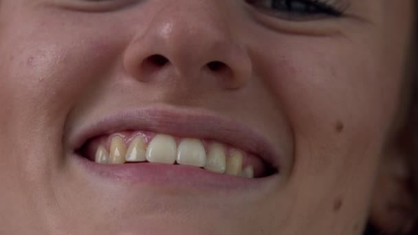 Visão Perto Boca Dos Dentes Uma Mulher Enquanto Sorri — Vídeo de Stock