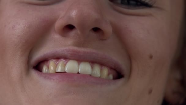 Close up view of a womans mouth and teeth as she smiles