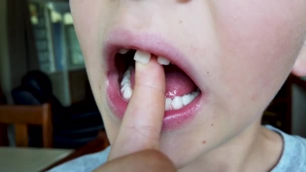男の子は指で緩んだ歯を振ります 極端なクローズアップ 子供の発達 — ストック動画