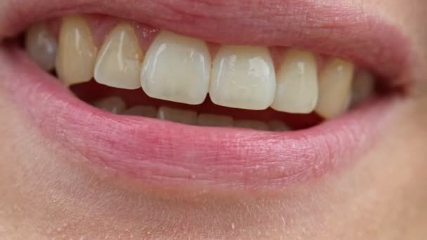 Macro Tiro Boca Sorrindo Com Aparelho Nos Dentes Inferiores Câmera — Vídeo de Stock
