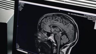 Bir kişinin baş manyetik rezonans görüntüleme sonuçlarını kapat