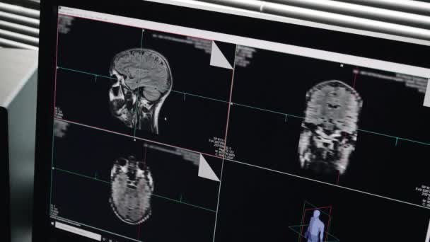 Close Shot Screen Display Monitor Showing Magnetic Resonance Imaging Scan — Stock Video