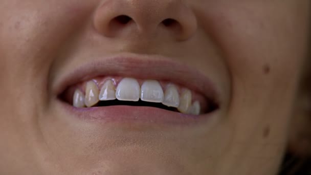 Detalhe Tiro Dos Dentes Mulher Sorriso Apertado Perto Capturado Estúdio — Vídeo de Stock