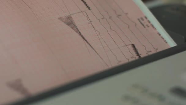 Ιατρικός Εξοπλισμός Που Δείχνει Τον Καρδιακό Ρυθμό Γράφεται Χαρτί — Αρχείο Βίντεο
