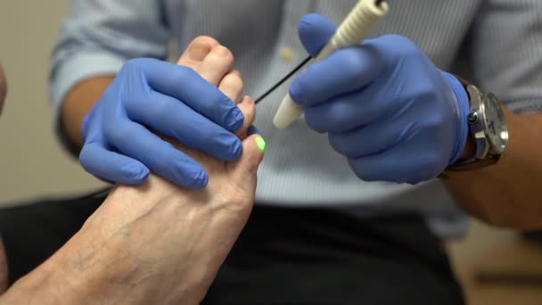 Žena dostává laserové treament na nehty nohou na pediatrické klinice