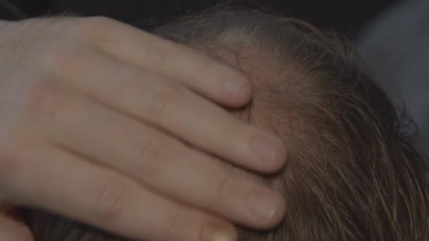 Close Hand Going Bald Spot Man Head — Stock Video