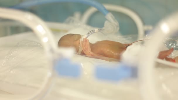 Premature Pasgeboren Baby Het Bad — Stockvideo