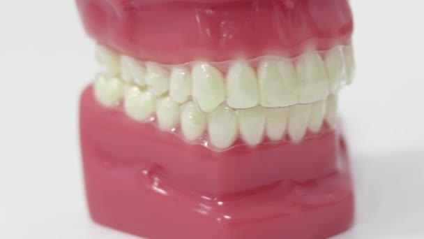 Denture Prosthesis Invisible Orthodontics — Stock Video