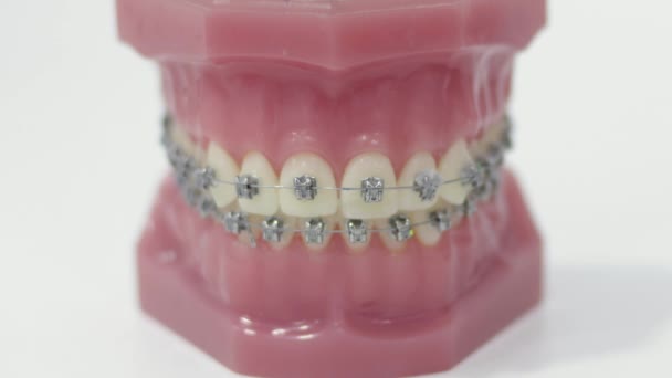 Dentes Falsos Com Ortodontia Consultório Médico — Vídeo de Stock