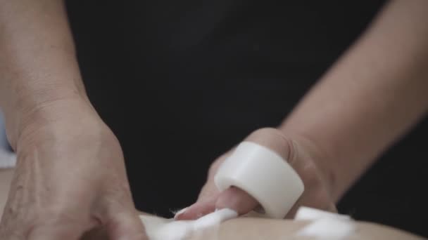 Hand Puts Surgical Tape Leg Cotton Sclerotherapy Treatment — 비디오