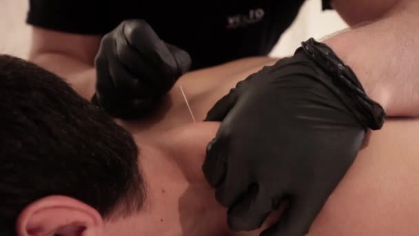 Akupunkturysta Wbijający Igłę Okolice Barku Leżącego Mężczyzny — Wideo stockowe