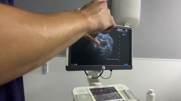 Professzionális Orvos Aki Elmagyarázza Ultrahangot Amit Csinált Egy Orvosi Klinikán — Stock videók