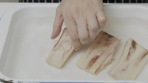 Placing Bone Marrow Tray Salt Water Soaking Removing Blood — Stock Video