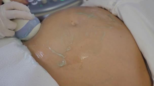 Ultraschall Schwangerschaftsschallwandler Blue Gel Schwangerschaftsbauch Ultraschall Scanner Nahaufnahme Leitfähiges Gel — Stockvideo