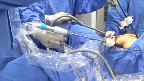 Fechar Mãos Equipe Cirurgiões Durante Instrumentos Laparoscopia — Vídeo de Stock
