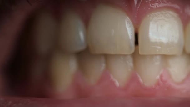 Tänder Med Mellanrum Mellan Dem — Stockvideo