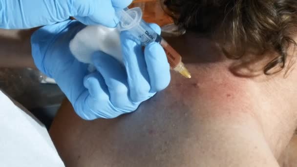 Blick Auf Neck Shoulder Injection — Stockvideo