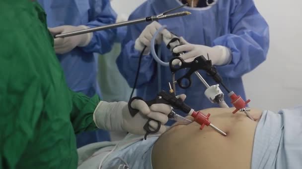 Pacjent Leżący Łóżku Operacyjnym Lekarze Uczestniczący Zabiegach Chirurgicznych — Wideo stockowe