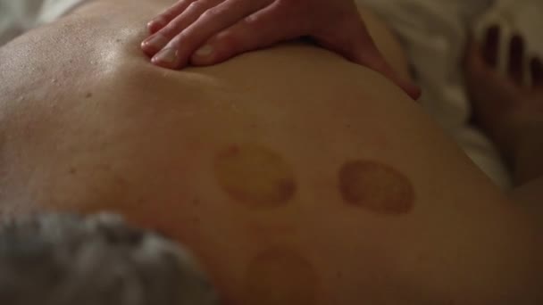 Mannelijke Therapeut Handen Massages Oudere Mannelijke Patiënt Schouders Met Cupping — Stockvideo