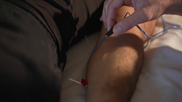 Doctor Applying Electrode Clamps Needles Patient Arm Electroacupuncture Session — Stockvideo