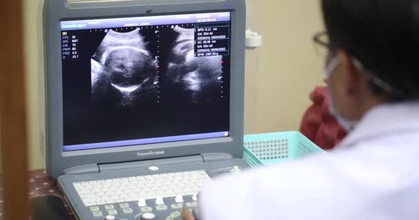 Arts Onderzoekt Een Zwangere Vrouwelijke Patiënt Met Echografie Zwangerschap Diagnosticeren — Stockvideo