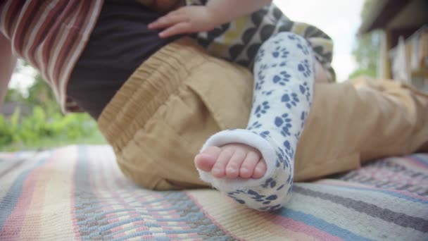 Yakın Çekim Küçük Bir Çocuğun Kırık Bacağının Parmaklarının Ucunda Annesinin — Stok video