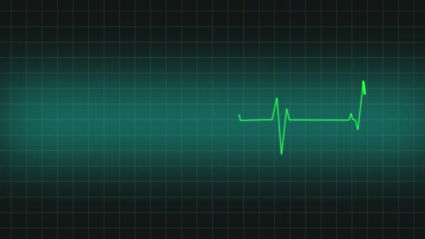 Heartbeat Animação Imagens Monitoramento Linha Sem Costura — Vídeo de Stock